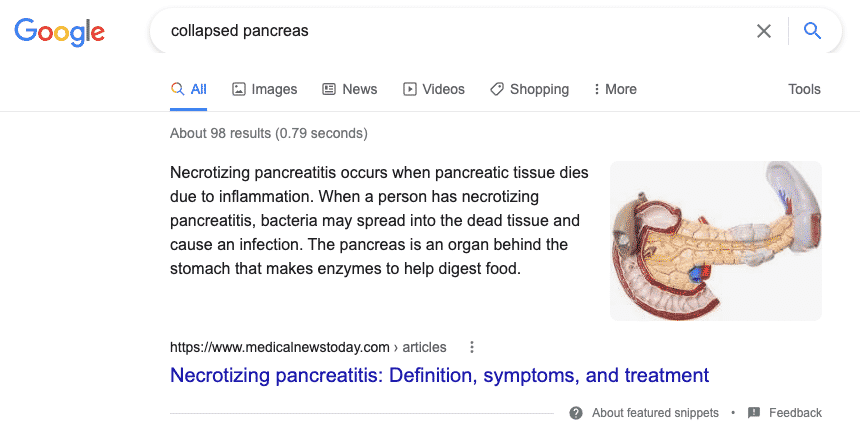 Featured snippet example Featured snippet example